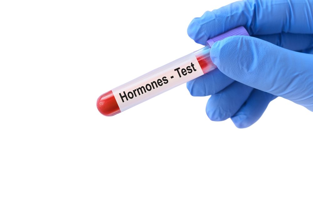 Hormones testing